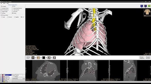 Analyze 14.0 - Display: Enhanced Movie Making with Sequencer