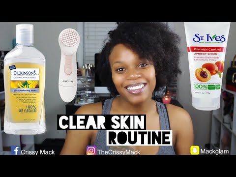 how-to-get-rid-of-acne-|-flawless-face-beauty-series-ep.-1-|-thecrissymack