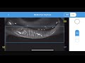 MeiboVue preview live video