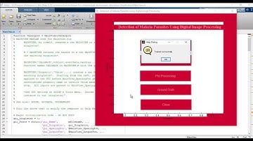 3D reconstruction dermoscopic skin lesion classification matlab projects