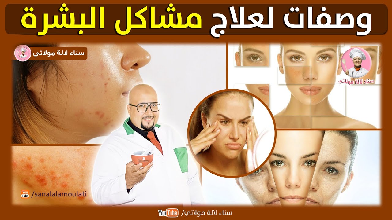 وصفات لمشاكل البشرة من عند الدكتور عماد ميزاب : الحبوب - توحيد لون البشرة - التصبغات - اتساع المسام