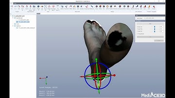 AFO Design with Sole by MediACE3D V1 2020