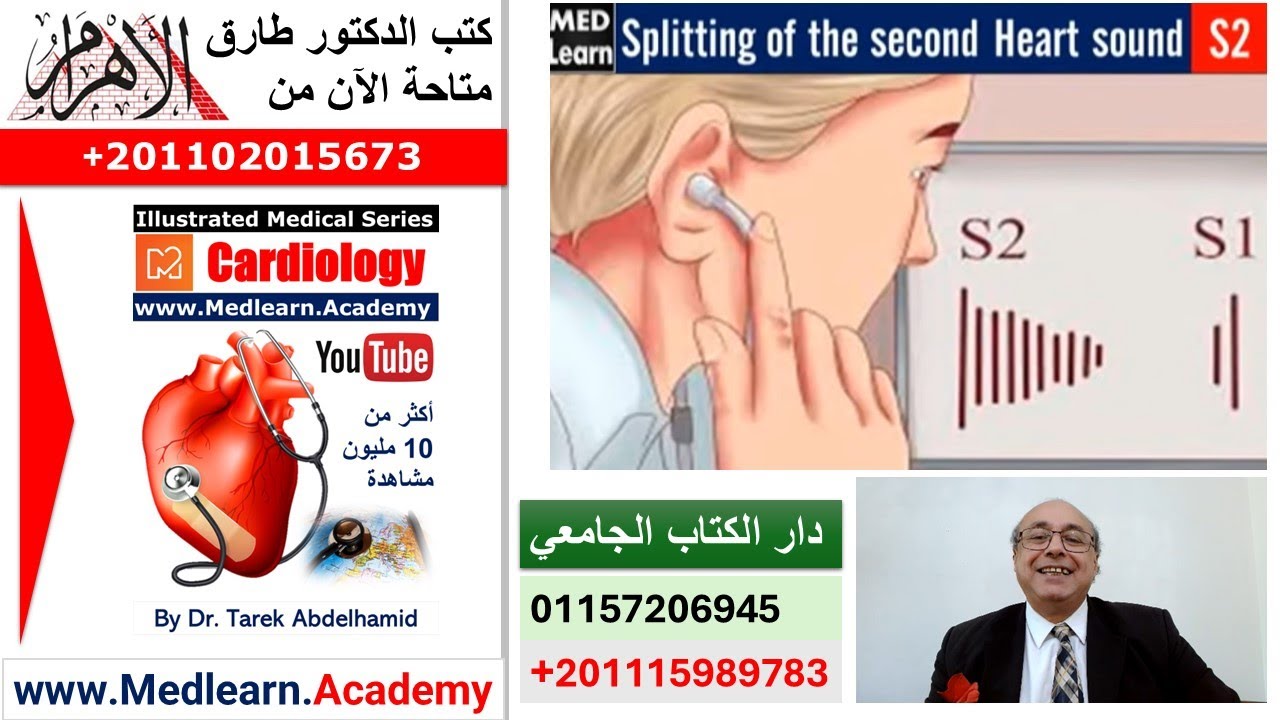 Splitting of Second Heart Sound (S2)   #internal_medicine #cme  #ecg #محاضرات_باطنة