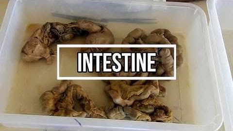 Intestines - small and large gross anatomy