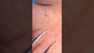 Gentle Stray Hair Removal | Daily Couple's Grooming