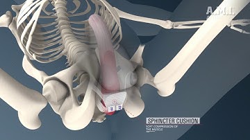 ATOMS Animation Treatment for Male SUI
