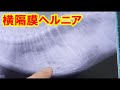 猫の外傷性横隔膜ヘルニア