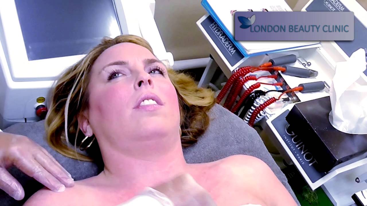 DECOLLETAGE TREATMENT - LONDON BEAUTY CLINIC