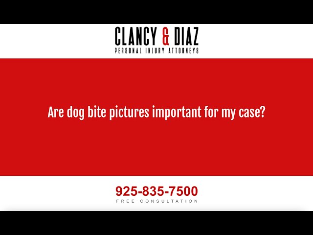 Are Dog Bite Pictures Important for My Case?
