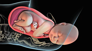 Wie kommt ein Baby durch den Geburtskanal?