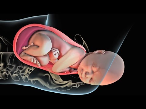 ვიდეო: მშობიარობა
