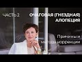 Очаговая (гнездная) алопеция: причины и методы коррекции. Часть 2