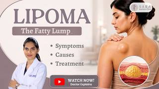 Lipoma Explained: Symptoms, Causes, Treatment & When You Need Surgery | Dr Ankita Jawanjal
