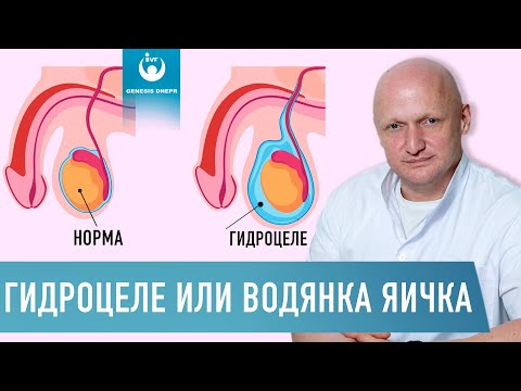 Видео: Обвисшие яички: это нормально? Плюс Хирургия, Упражнения, Другие Обработки