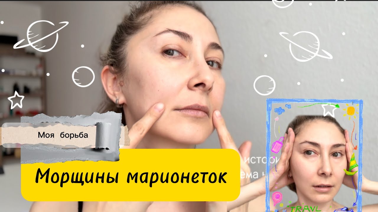 Как я убираю морщины марионетки: массаж + осанка + мьюинг. Делюсь комплексом. 