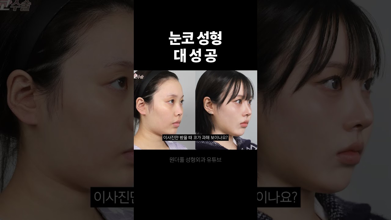 [Вондэрфул гоо заслын эмнэлэг] Нүд, хамарны мэс засал маш амжилттай боллоо.