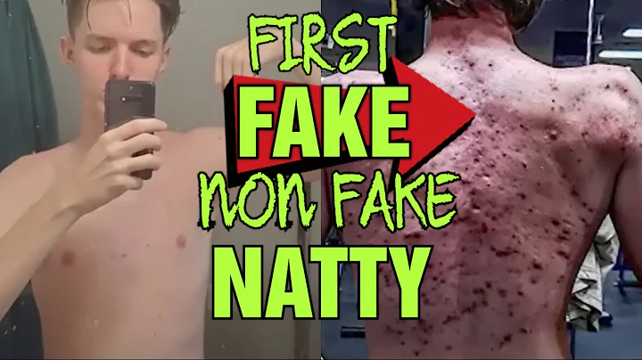 First Fake NON FAKE Natty