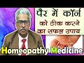 कॉर्न को कैसे ठीक करे - Corns Treatment - Dr. P.S. Tiwari