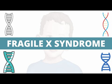 Fragile X Syndrome - Pathology, Signs & Symptoms, Diagnosis 