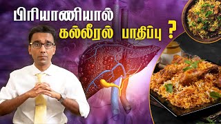 Eating biryani can cause LIVER damage - How to eat in a healthy way? (Tamil)