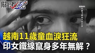 越南11歲童「血淚」狂流 印尼女鐵線竄出身體20多年無解？！ 關鍵時刻 20180912-6 黃創夏   王瑞德
