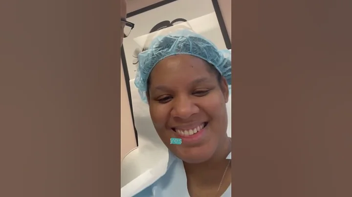 ALARPLASTY (NOSTRIL NARROWING) FROM NEW JERSEY - DR. TANVEER JANJUA - NEW JERSEY