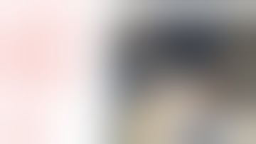 Excision of Neck Mass Using the HARMONIC FOCUS+ Shears with David Goldenberg, MD | J&J MedTech