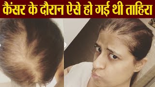 Tahira Kashyap shares her cancer journey with latest post | FilmiBeat