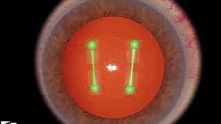EyeSi CAT C Cracking & Chopping Training, Level 8