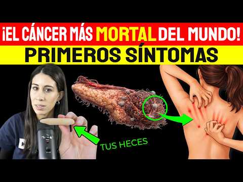 8 Early Symptoms of Pancreatic Cancer: Don't Ignore Them!