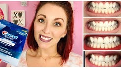 Crest 3D White One Hour Express Whitestrips/ CREST WHITENING BEFORE AND AFTER REVIEW 