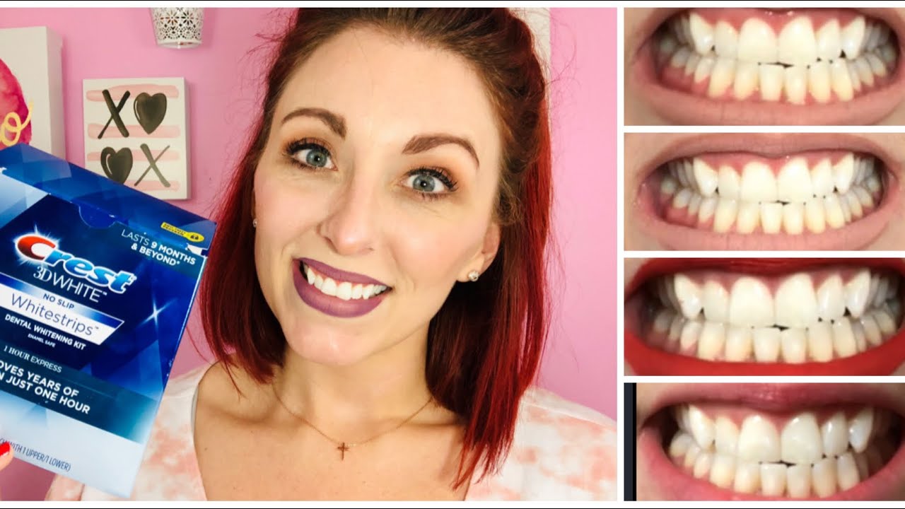 Crest 3d White One Hour Express Whitestrips Crest Whitening Before And After Review Youtube