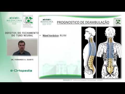 Defeito do Fechamento do Tubo Neural - Dr. Fernando A. Duarte