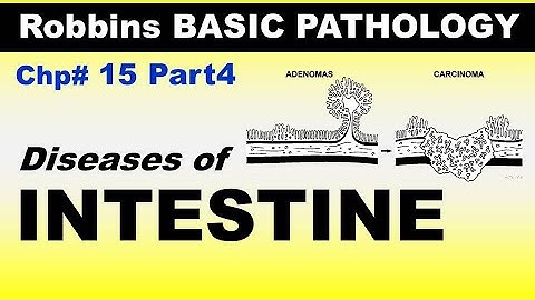 Chp15 (Part4) Robbins Basic Patho | Diseases of INTESTINE | Dr Asif Lectures