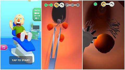 ✅Earwax Clinic Max levels Game Mobile Update All Trailers ios, Android Gameplay Walkthrough 336