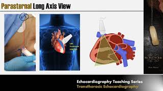 Lecture 2 - Transthoracic Echocardiography Part 1