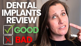 What I Didn't Like About My Dental Implants  4 Years Later...
