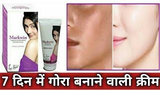 markwin pregnancy stretch marks wrinkle cream  Reviews in Hindi // markwin cream Use in Hindi