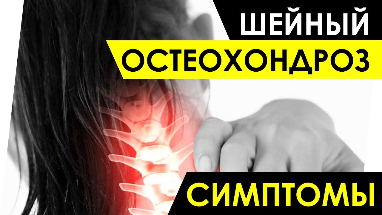 Шейный остеохондроз симптомы