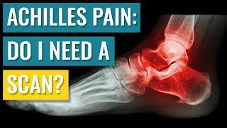 Do You Need A Scan For Achilles Tendinopathy?