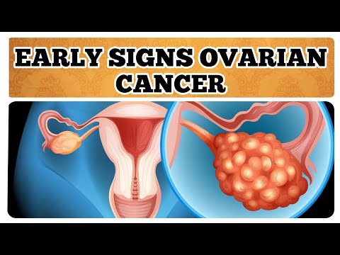 4 Early Ovarian Cancer Symptoms Every Woman Should Be Aware Of