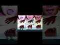 Cyanosis in Negro Explained | Why Skin Turns Blue | Medicine Shorts #stemmed #investing