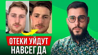 Вот как просто убрать отеки! Без спорта и лекарств