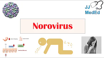 What are the first signs of Norovirus?
