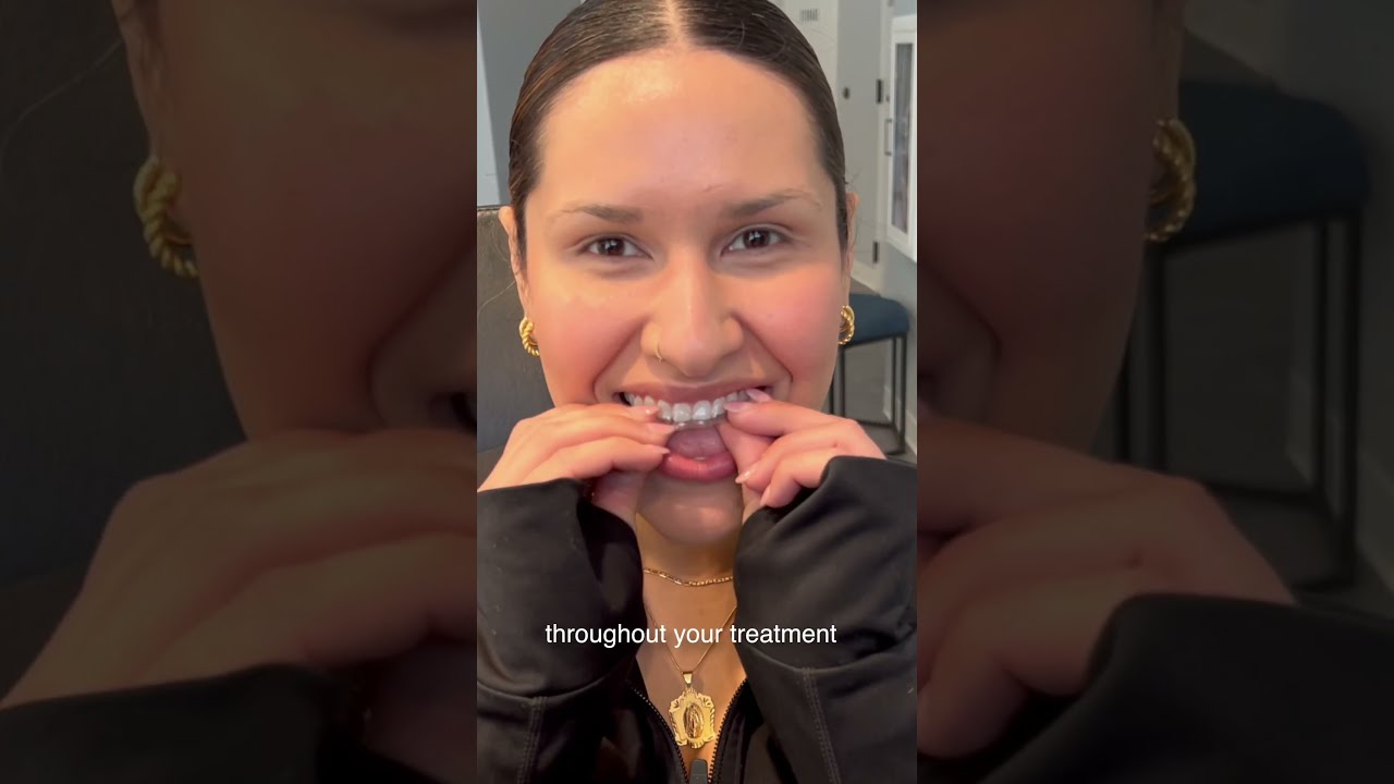 Why Some People Choose Invisalign Over Braces 