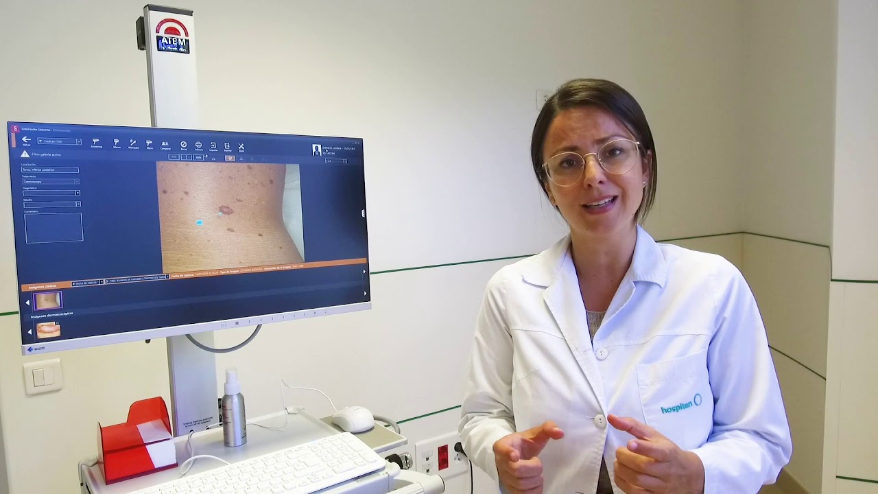 FotoFinder Bodyscan en Hospiten Roca, Gran Canaria