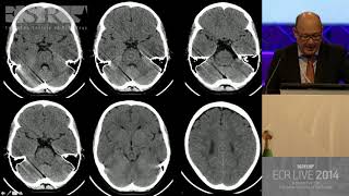 Neuro - Pitfalls in brain imaging 1