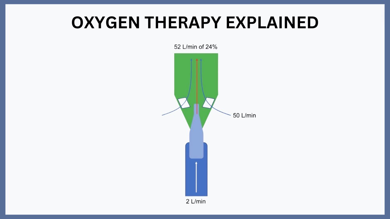 Объяснение кислородной терапии