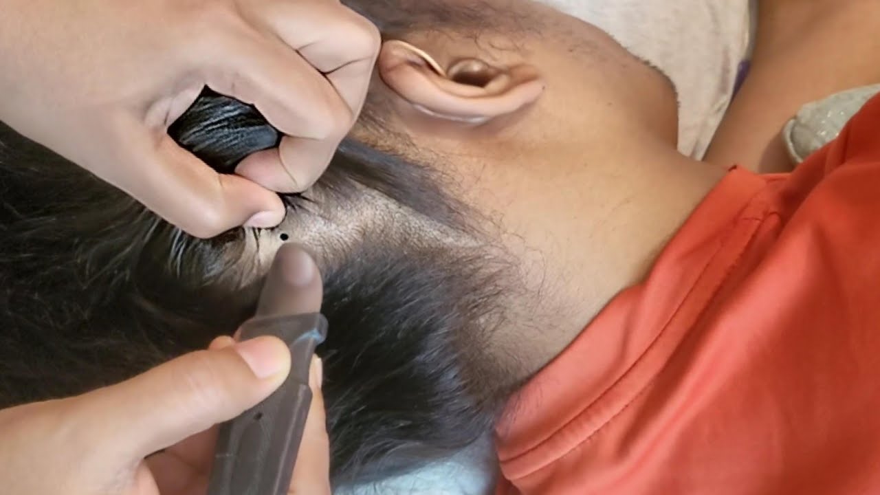 ASMR Scalp Check: The Most Relaxing Experience Ever(Real Person)✨