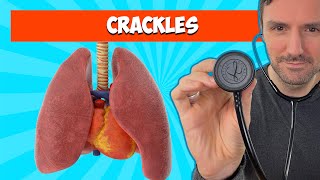 Fine and Coarse Crackles: Lung Sounds For Beginners 🔥🔥🔥